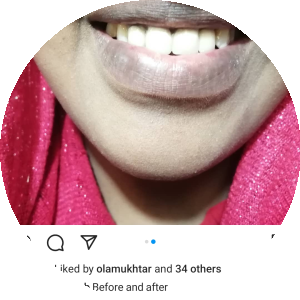 بروفايل Samar